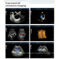 PT580 3D Color Doppler Ultrasound Diagnosis System